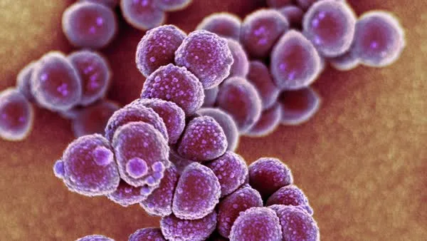 El MRSA (*Staphylococcus aureus* resistente a la meticilina) es una notoria 'superbacteria' que ha desarrollado re