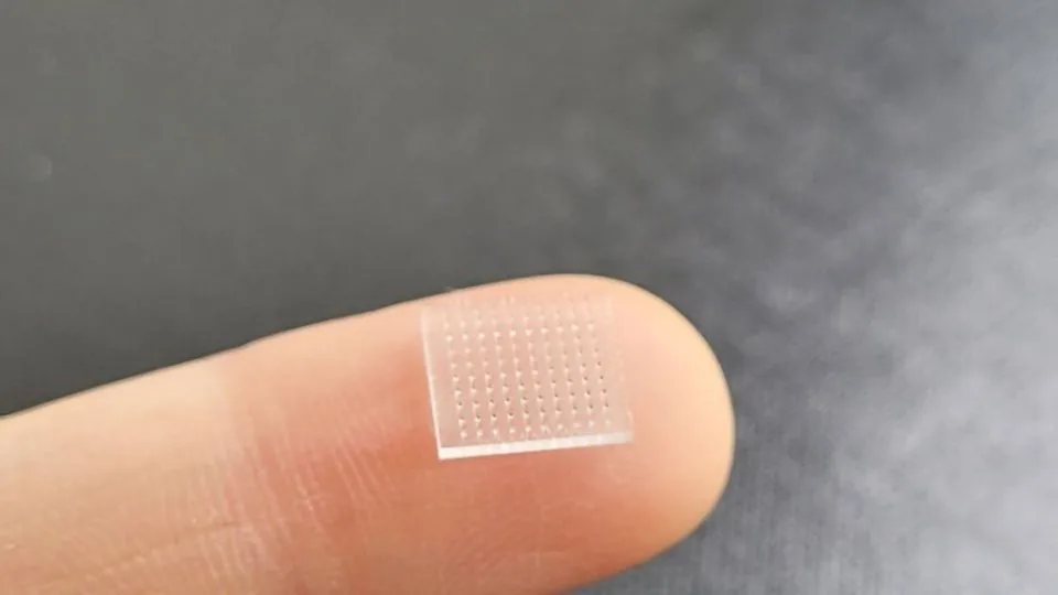Microneedle vaccine patches are an innovative delivery method being researched for future immunizati