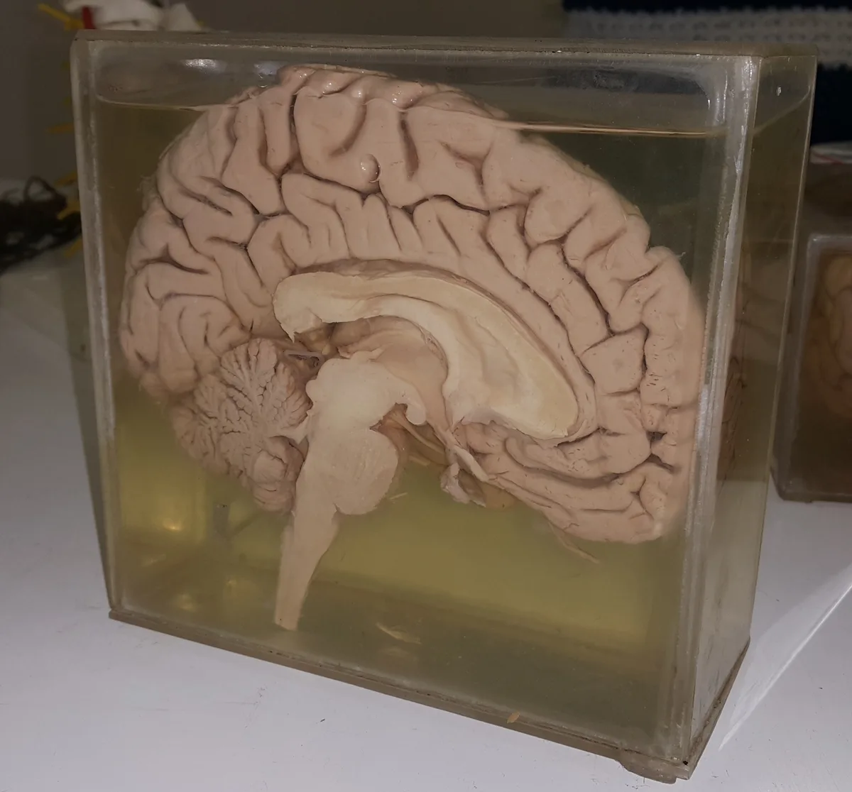 The human brain, weighing about 3 pounds, is the most complex organ in the body, responsible for all